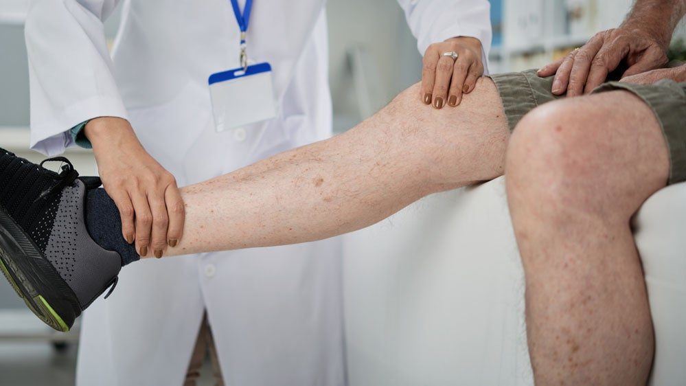 Knee replacement Procedure at Canova Medical Liverpool